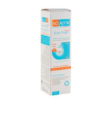 فوم شستشو نو آکنه مدل Acne Solution مناسب پوست چرب و جوش دار حجم 150 میل